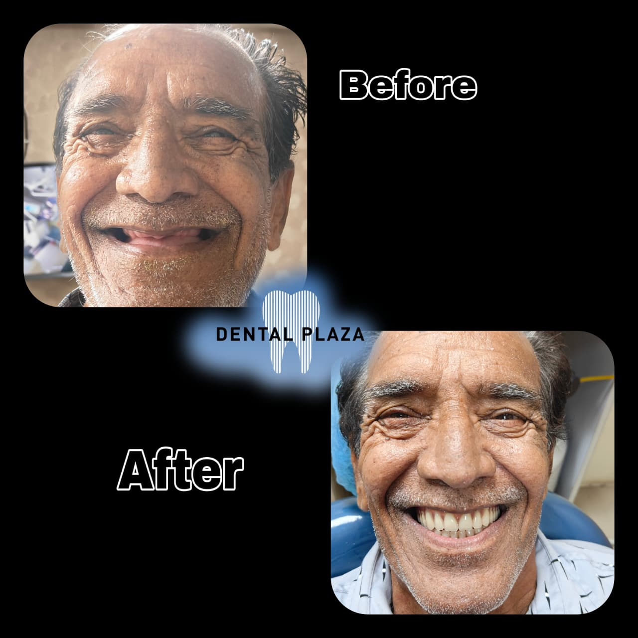Full Smile Restoration