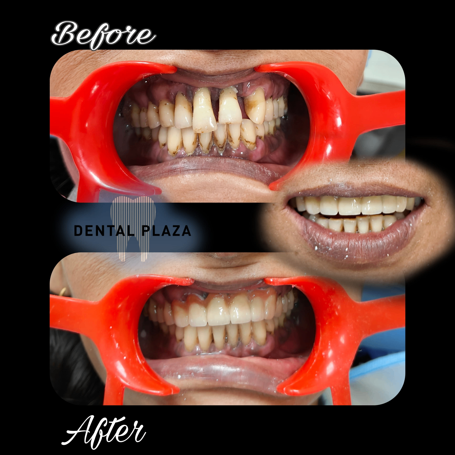 Deep Cleaning & Restoration